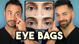 How Treat Under Eye Bags Like A Dermatologist [upl. by Repohtsirhc]