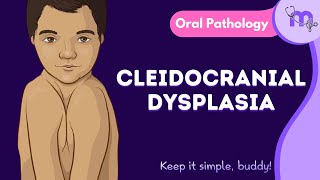 Cleidocranial Dysplasia  Features  Oral Manifestation  Treatment  Oral Pathology  Animated [upl. by Wolfy573]