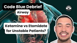 Ketamine vs Etomidate for Unstable Patients  Rapid Sequence Intubation  CodeBlueDebrief [upl. by Nosiaj]