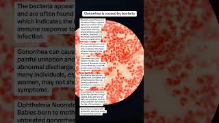 Neisseria gonorrhoeae is bacteria for gonorrhea sexually transmitted infection microbiology [upl. by Haleemaj]