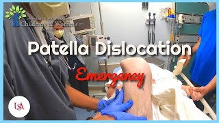 Patella Dislocation Emergency [upl. by Base979]