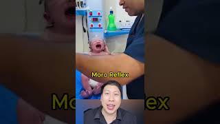 ไม่ได้แกล้งเด็กนะแต่นี่คือ Moro Reflex สาระ facts knowledge เรื่องเล่า funny moro reflex [upl. by Duer289]