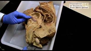 Vídeo 27 Anatomía visceral de la pelvis masculina sobre corte sagital de pelvis de cadáver [upl. by Ynnor]