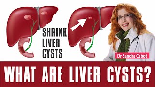 LIVER CYST  Symptoms  Natural Treatment  Diet  Supplements  Is a livercyst Dangerous [upl. by Kore]