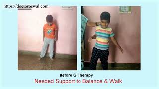 Leukodystrophy treatment  Dr Oswals G Therapy  Leucodistrofia Leukodystrophie حثل المادة البيضاء [upl. by Narba120]