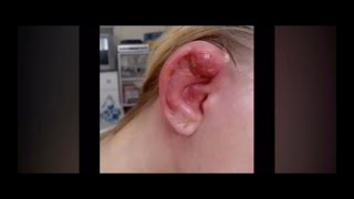 Infected Industrial Piercing 2008 [upl. by Chavaree]