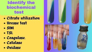 Biochemical Test  Bacterial Identification Technique Microbiology Practical Exam bacteriology [upl. by Revilo]