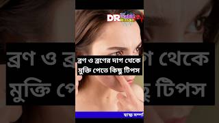 ব্রণ বা ব্রণের দাগ দুর করার উপায়  ব্রণের দাগ থেকে মুক্তি পাবো কিভবে ব্রণদূরকরারউপায় ব্রণ [upl. by Stearn904]