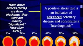 What Does Your Stress Test Really Mean  The Princeton Longevity Center [upl. by Atims]