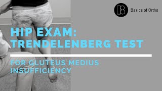 Hip Exam Trendelenberg Test for Gluteus Medius Insufficiency [upl. by Nythsa]