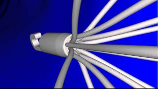 Simulation of Inferior Vena Cava IVC Filter Deployment and Blood Flow in a PatientSpecific Model [upl. by Silvana]