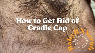 How to Get Rid of Cradle Cap  Frida Baby  Mustela [upl. by Ahseuqal619]