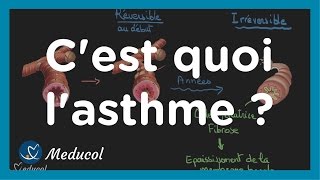 Lasthme cest quoi physiopathologie causes symptômes et traitement [upl. by Maram]