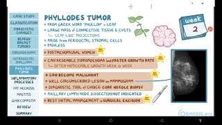 Benign breast conditions  pathology review  Osmosis [upl. by Lovell529]