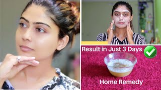 OMG 😮 This Facial Remove Your Dark Spots Brown Spots Pigmentation amp Pimples in just 3 Days [upl. by Janean]