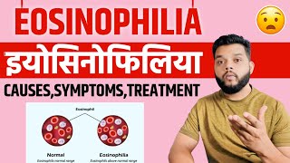 Eosinophilia Causes Symptoms amp Treatment In Hindi [upl. by Novah556]