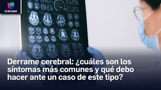 Derrame cerebral ¿cuáles son los síntomas más comunes y qué debo hacer ante un caso de este tipo [upl. by Janifer]