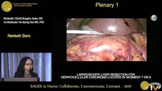 Laparoscopic liver resection for hepatocellular carcinoma located in segment 7 or 8 [upl. by Abrahams]