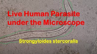 Human Parasites Live under the Microscope  Strongyloides stercoralis [upl. by Lea]