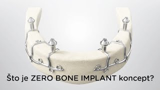 Što je ZERO BONE IMPLANT koncept [upl. by Osnola238]