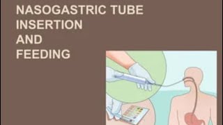 NG tube insertion a step by step guide [upl. by Nivek]