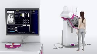 Sinomdt Tomosynthesis 3D Digital Mammography Machine Introduction [upl. by Voccola]