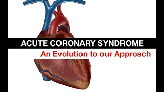 Evolving our Approach to Acute Coronary Syndrome ECGs OMINOMI [upl. by Politi]