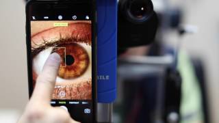 How to use iPhone AEAF lock for Slit Lamp Photography [upl. by Ueih695]