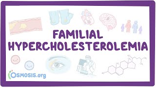 Familial hypercholesterolemia  an Osmosis Preview [upl. by Odrareve]