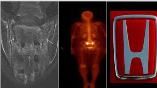 Radiology 🛑 signs 115 case in 15 minutes radiopediamrictxraymammographyanatomyexamsfrcrtip [upl. by Andra]