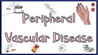 Peripheral Vascular DiseasePVD Causes Signs amp Symptoms Diagnosis ampTreatment [upl. by Eskill]