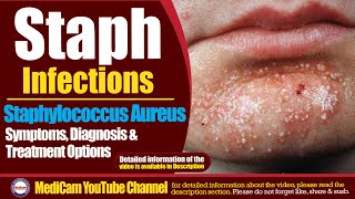 Staphylococcus Aureus Symptoms Treatment And Prevention [upl. by Izy]