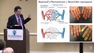 2015 Nashville The Scleroderma Hands and Their Care Dr Francesco Boin [upl. by Anialeh]