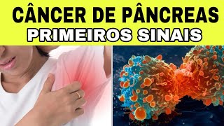 7 Sinais Iniciais de CÂNCER de PÂNCREAS Sintomas de Insulinoma [upl. by Eelyk]