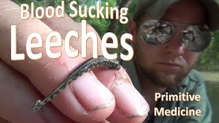 Leech Bitten Encounters and Primitive Medicinal Application [upl. by Valente]