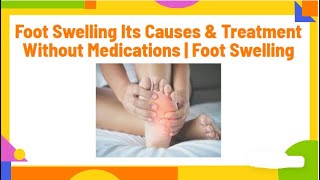 foot swelling its causes amp treatment without medications  foot swelling PhysiotherapyKnowledge [upl. by Blossom914]