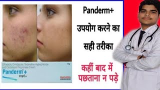 panderm cream review  panderm plus lagane se kya hota hai  penderm [upl. by Inwat]