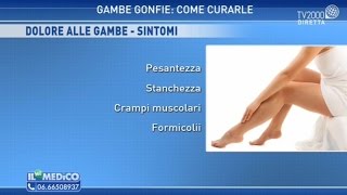 Il mio medico  Gambe gonfie come curarle [upl. by Akemaj]