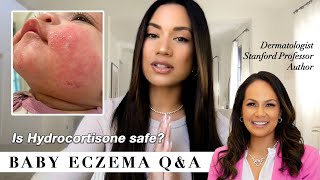 Baby Eczema QampA treatment amp tips from a leading Dermatolgist [upl. by Gruber]