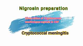 Cryptococcal meningitis observation of Cryptococcus neoformans capsule in nigrosin preparation [upl. by Alexine]