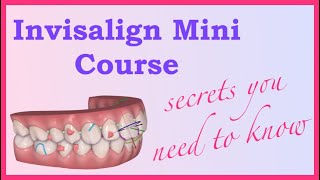 The Basics  Invisalign Mini Course 1 of 8 [upl. by Iraj139]