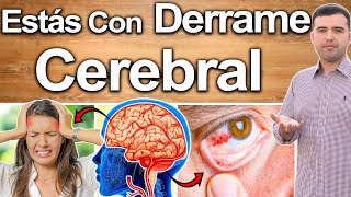 Esto Indica Derrame Cerebral  Síntomas De Un Derrame En El Cerebro Y Cómo Revertirlo Rápido [upl. by Mlehliw]