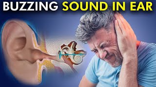 Tinnitus Annoying sound in Ear Causes and Treatments strategies [upl. by Tonye]