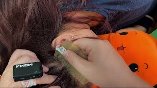 Relaxing ASMR Scalp Care Gentle Dandruff Removal for Sleep and Stress Relief [upl. by Ewold]