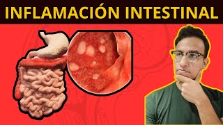 5 COSAS QUE TE INFLAMAN EL INTESTINO Síndrome de Intestino Irritable [upl. by Anotyad924]