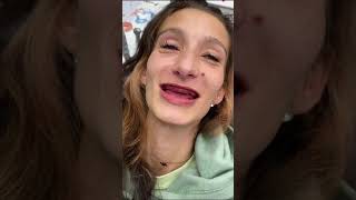 Dentist Gives Woman Who Had Teeth Removed Her Smile Back [upl. by Myer843]