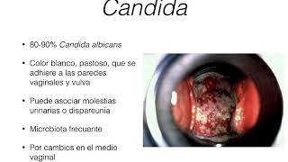 Leucorrea metrorragia dispareunia [upl. by Lydell]