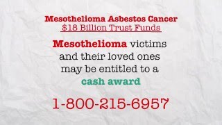 Mesothelioma Asbestos Cancer 18002156957 [upl. by Arba]