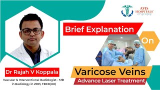 Varicose Veins Laser treatment Explained Dr Rajah V Koppala  Avis Hospitals [upl. by Nojid676]