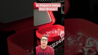 Aligners Vs Braces Which one winsyoutubeshorts shorts short shortsvideo dentist [upl. by Bergess473]